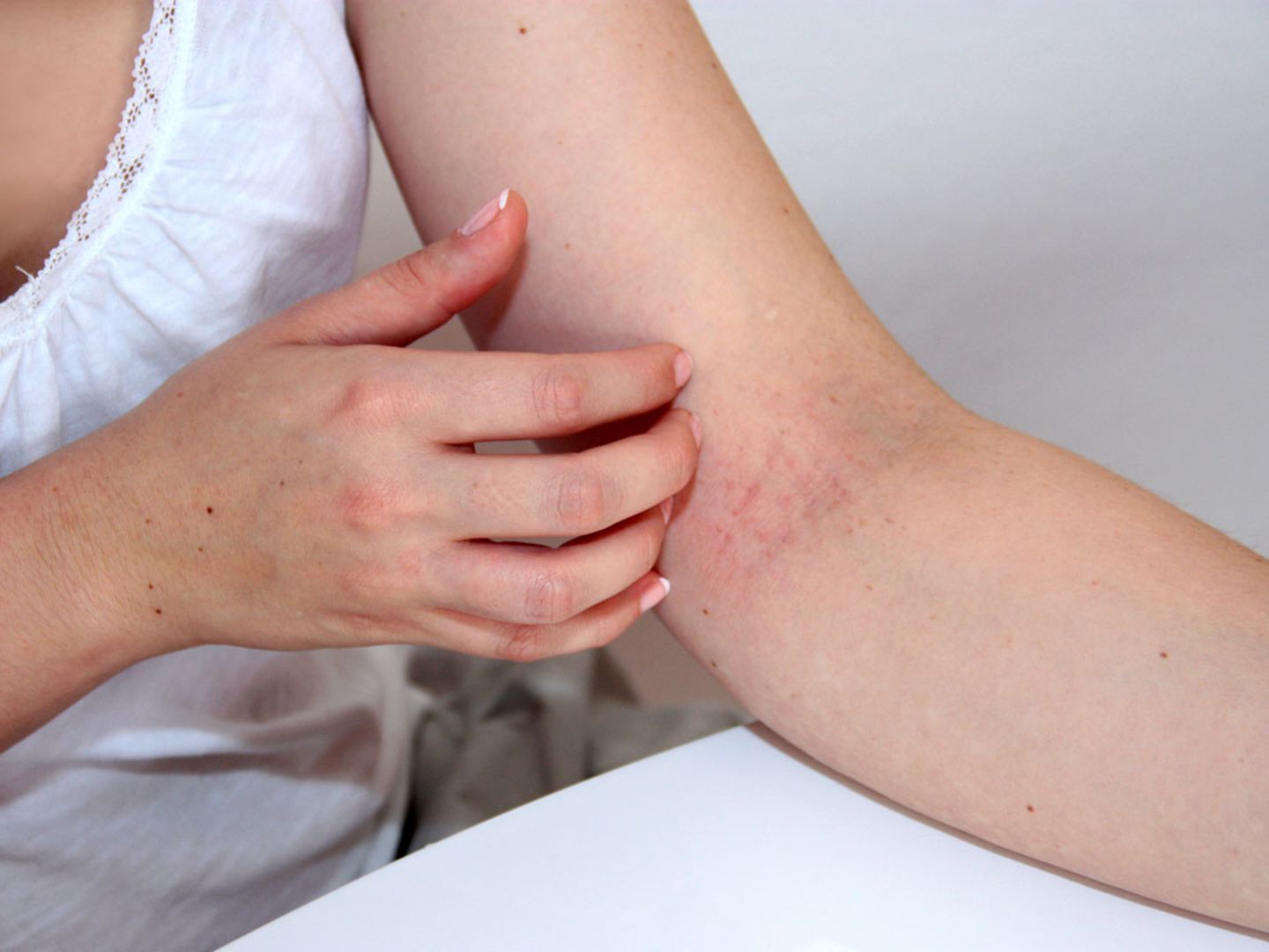 Kortisonsalbe Richtig Erbauen